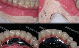 沈阳阳光口腔种牙效果好不好？价格贵不贵？靠谱吗？