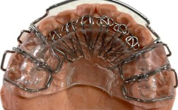 正畸舌簧制作方法