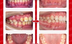 矫正牙齿脸型会变好看吗？颜值提升有科学依据？
