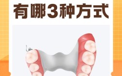 镶牙齿的方法有哪些？不同镶牙技术在价格、美观度和耐用性上各有什么差异，该如何选择最适合自己的？