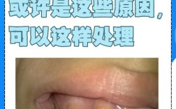 正畸牙齿矫正为何会引发牙龈增生？背后原因、影响及应对方法有哪些？
