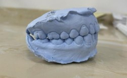 牙齿矫正取模后的牙模，患者能带走吗？