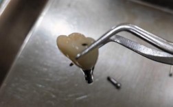 大连种植牙加工的流程、技术及质量如何全面把控？