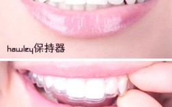 正畸保持器如何调整形状