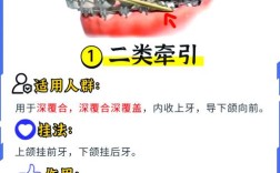 牙齿牵引有哪些常用方法？哪种最合适？