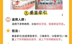 牙齿矫正橡皮圈的作用是什么？为何医生总让戴？