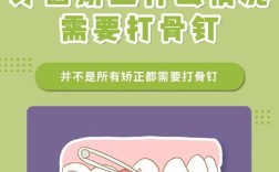 正畸不打骨钉可以吗