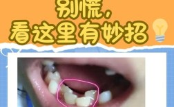 种牙歪了怎么办