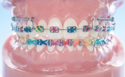 矫正牙齿会影响口腔健康和面部美观吗？利弊有哪些？