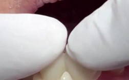 做过美牙冠后还能进行牙齿矫正吗？美牙冠会影响正畸效果或对牙齿健康造成额外风险吗？