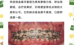 MBT矫正牙齿的副作用有哪些？是否会对牙齿健康造成影响？