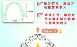 只扩弓不正畸可以吗