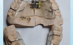 口腔正畸摄影器械