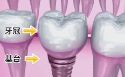 内蒙古3D种牙机构数量有多少？