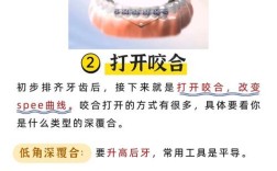 牙齿正畸后恢复期一般需要多长时间？