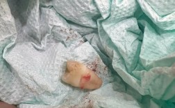 牙齿矫正下牙拔一颗