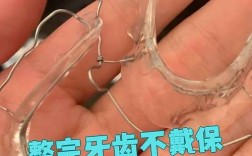 矫正后牙齿不咬合？原因探究与解决方法全解析