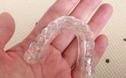 正畸下颌颌垫制作的关键步骤与注意事项有哪些？