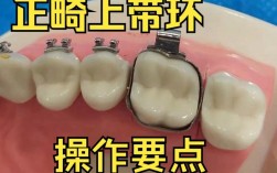 正畸期间带环的牙松动是什么原因导致的？