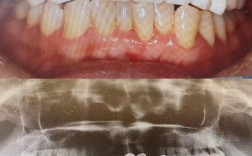 上海牙齿美容冠矫正效果如何？价格与适合人群是怎样的？