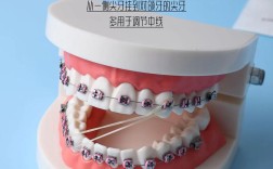正畸牵引线是什么？矫正牙齿时它有何作用？
