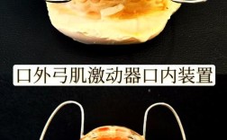 牙齿矫正器怎么选？哪种类型更适合自己？