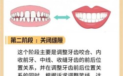 矫正牙齿有几种方法？不同矫正方式各有哪些优缺点，该如何选择适合自己的？