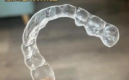 东莞矫正牙齿哪家好？求靠谱推荐！