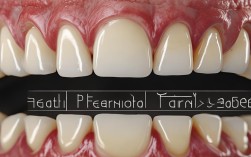 牙齿矫正后牙周病为何频发？原因、预防与治疗指南？
