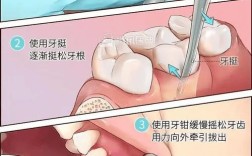 无痛拔牙有几种方法？不同方式优缺点及适用情况解析？