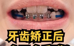牙齿矫正后反弹，这到底是怎么回事？