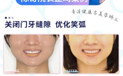 美学正畸关节联合论坛，如何实现功能与美学协同？