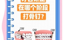 正畸结扎钉的作用有哪些？矫正效果如何？