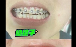 沈阳牙齿矫正去哪儿靠谱？专业机构怎么选？