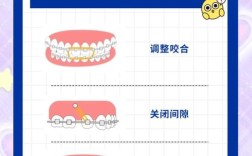 正畸橡皮圈的选择