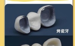 做烤瓷牙好还是正畸好