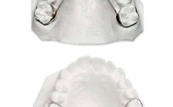 正畸nance弓的适应症具体包括哪些？