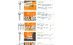 口腔正畸支抗如何科学选择？关键因素有哪些？