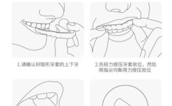 正畸用的胶怎么弄掉？求简单去除方法