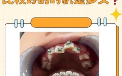 长安牙齿矫正哪里做比较好？