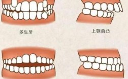 正畸费用高，没钱该如何是好？