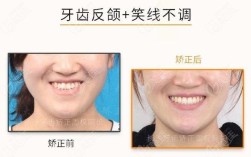 周权正畸什么水平