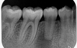 根尖发育发育与正畸