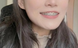 25岁后矫正牙齿，年龄大了还来得及吗？