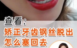 矫正后牙齿变形了，该如何有效解决？