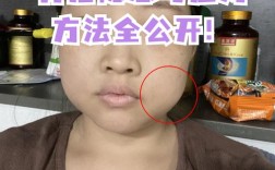 种牙后脸肿怎么快速消肿？实用方法有哪些？