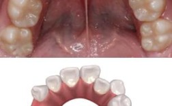 杀神经的牙还能正畸吗？