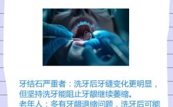 牙缝宽最好处理方法是什么？哪种方式更安全有效？