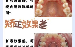 矫正牙齿排齐需要多久？