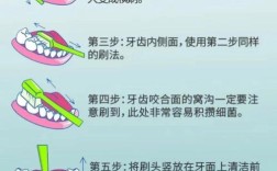 牙槽清洁方法